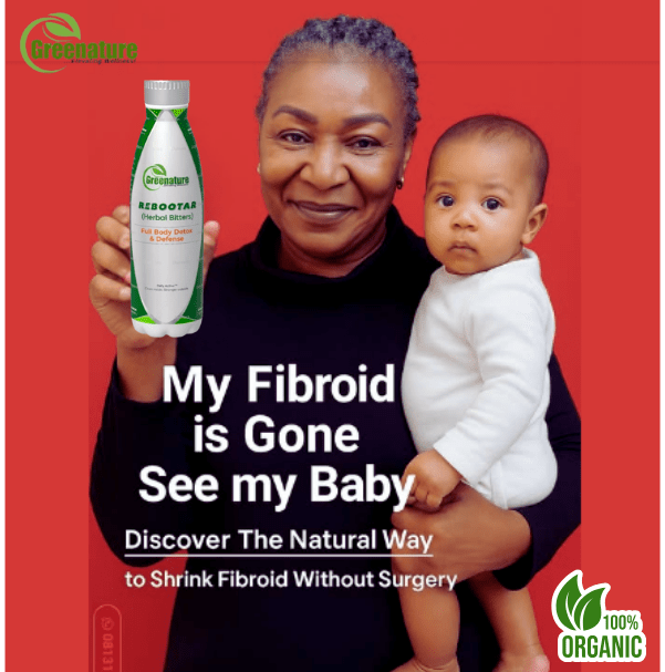 Fibroid No Surgery-min